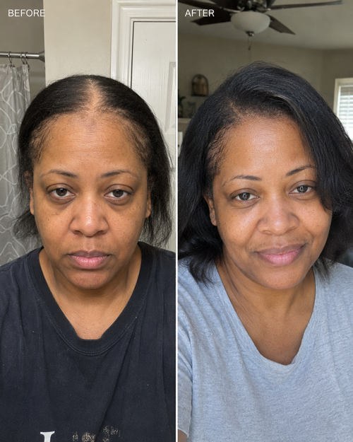 ROOTED — Rosemary & Rice Water Hair Spray